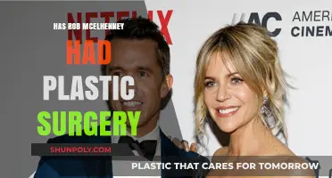 Rob McElhenney's Transformation: Plastic Surgery Rumors Explored