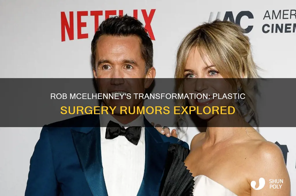 has rob mcelhenney had plastic surgery