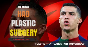 Robaldo's Transformation: Plastic Surgery Rumors and the Truth Behind Them