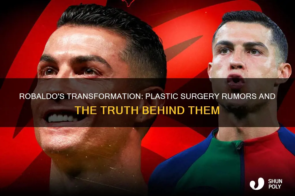 has robaldo had plastic surgery