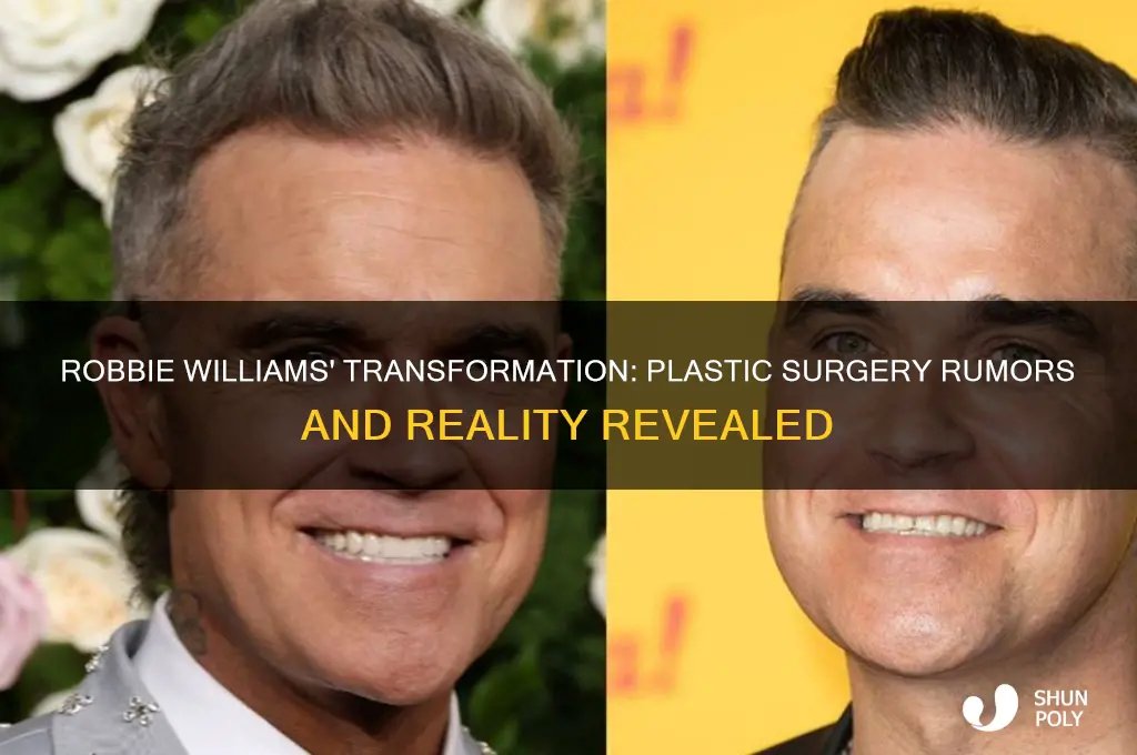has robbie williams had plastic surgery