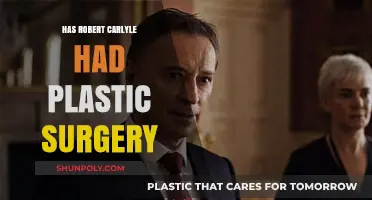 Robert Carlyle's Transformation: Plastic Surgery Speculations and Truths Revealed