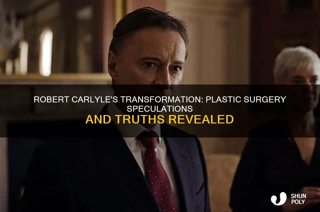 has robert carlyle had plastic surgery