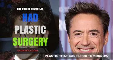 Robert Downey Jr.'s Transformation: Plastic Surgery Rumors Explored