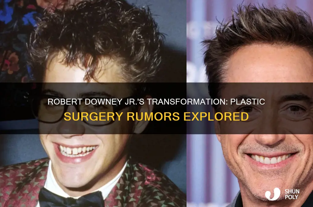 has robert downey jr had plastic surgery