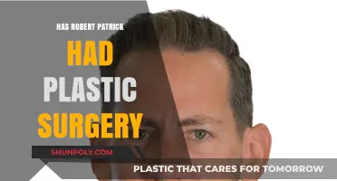 Robert Patrick's Transformation: Plastic Surgery Speculations and Truths