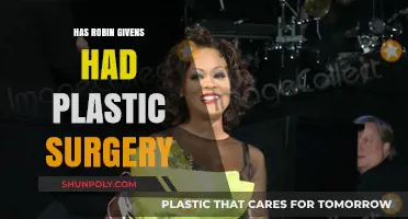 Robin Givens Plastic Surgery: Fact-Checking the Rumors and Speculations