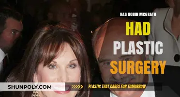 Robin McGrath Plastic Surgery: Fact-Checking the Rumors and Speculations
