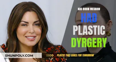 Robin McGraw's Plastic Surgery: Fact or Fiction?