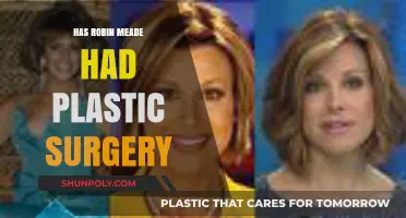 Robin Meade's Transformation: Plastic Surgery Speculations and Facts Revealed