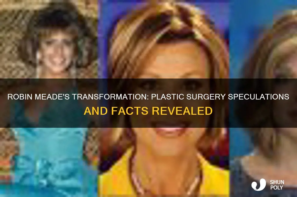 has robin meade had plastic surgery