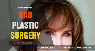 Has Robin Phil Undergone Plastic Surgery? Unveiling the Truth