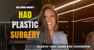 Robin Roberts Plastic Surgery: Fact-Checking the Rumors and Speculations