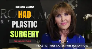 Robyn McGraw's Transformation: Plastic Surgery Speculations and Truths Revealed