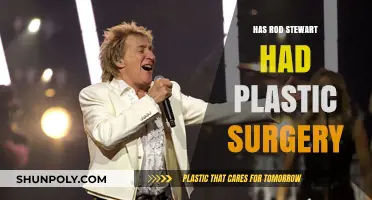 Rod Stewart's Changing Looks: Plastic Surgery Rumors Explored