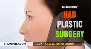 Roger Stone's Transformation: Plastic Surgery Speculations and Truths Revealed