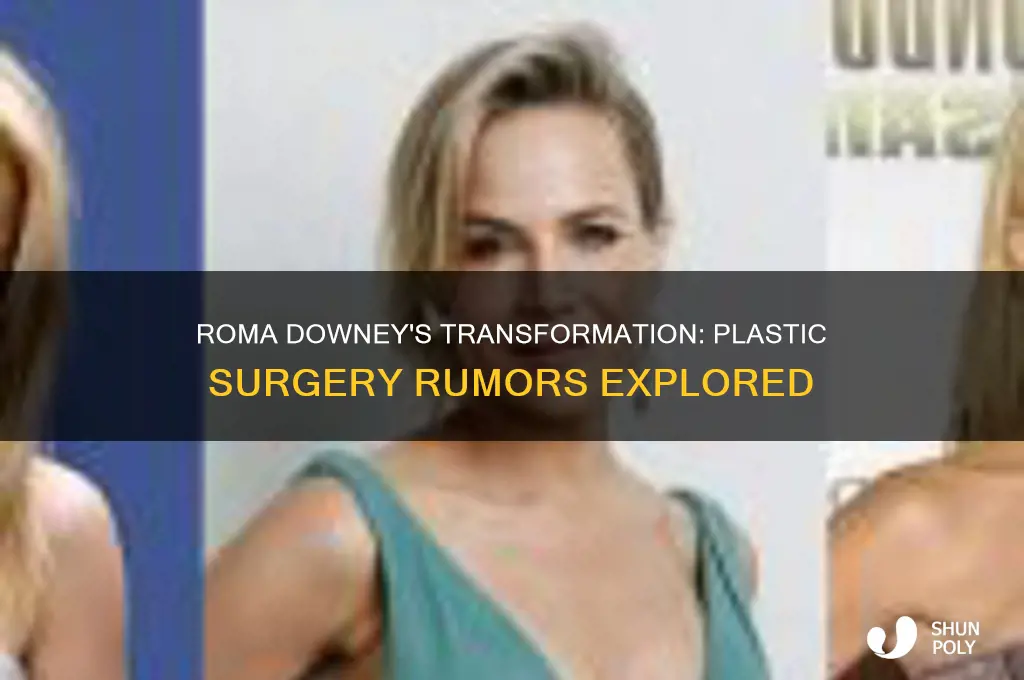 has roma downey had plastic surgery