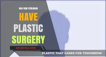 Ron Perlman Plastic Surgery: Fact or Fiction? Unveiling the Truth
