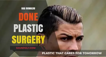 Has Ronaldo Had Plastic Surgery? Uncovering the Truth Behind the Rumors