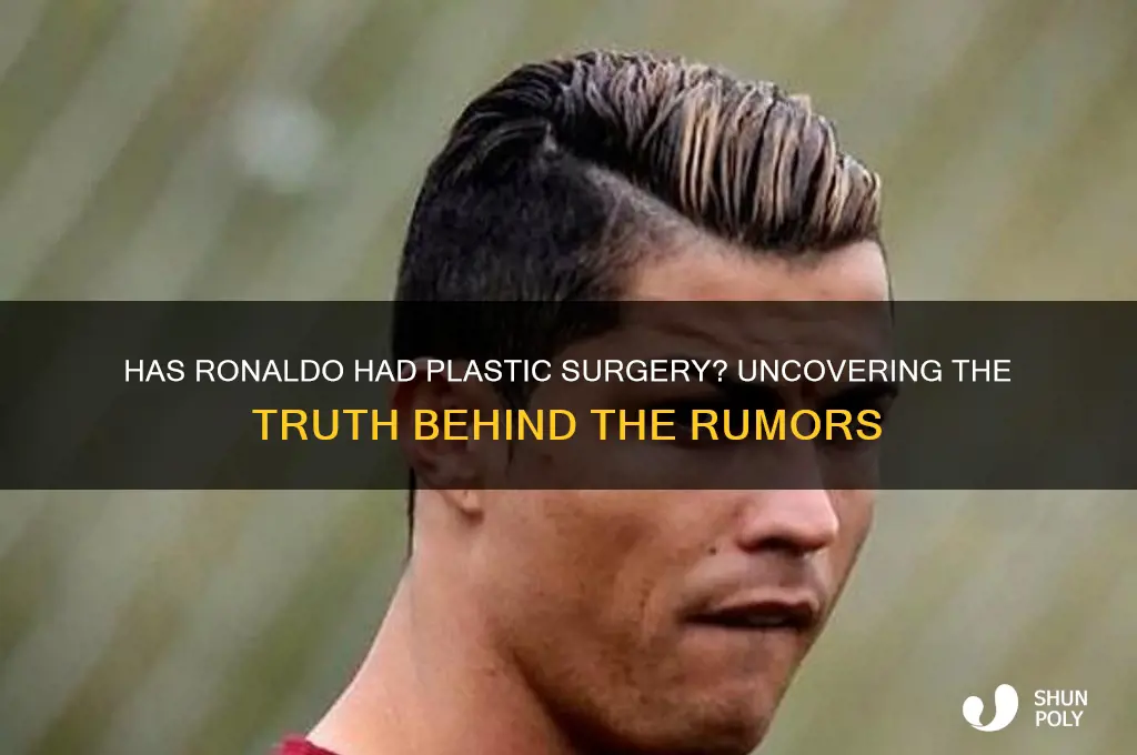 has ronaldo done plastic surgery