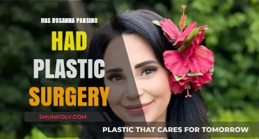 Rosanna Pansino's Transformation: Plastic Surgery Rumors Explored