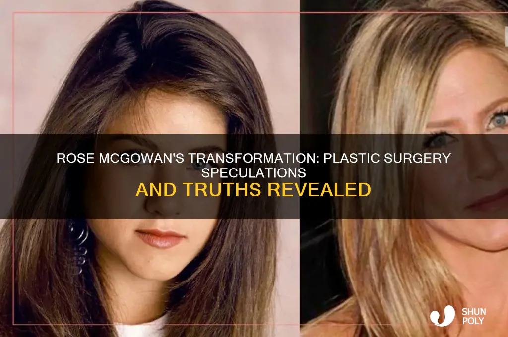 has rose mcgowan had plastic surgery