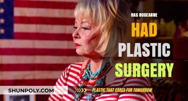 Roseanne's Transformation: Unveiling the Truth About Her Plastic Surgery