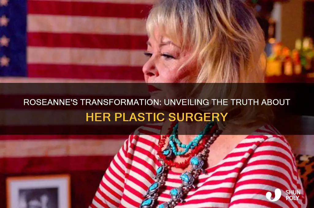 has roseanne had plastic surgery