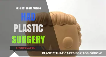 Has Ross from Friends Had Plastic Surgery? Unveiling the Truth