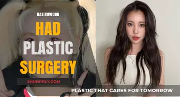 Rowoon Plastic Surgery Rumors: Fact-Checking the Actor's Transformation