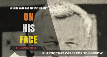 Roy Horn's Face Transformation: Plastic Surgery Speculations Explored