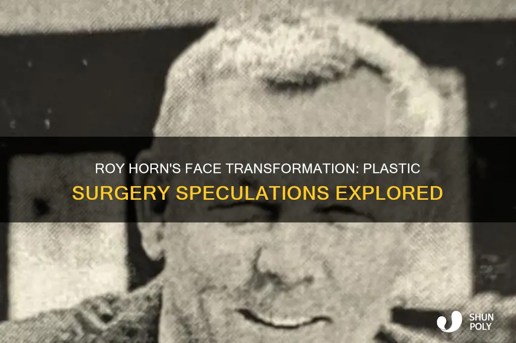 has roy horn had plastic surgery on his face