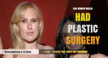 Rumer Willis Plastic Surgery: Fact-Checking Transformation Rumors and Truths