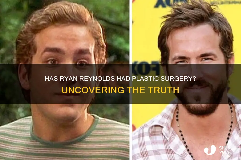 has ryan reynolds get plastic surgery