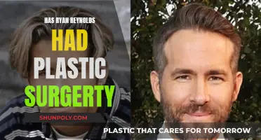 Ryan Reynolds: Plastic Surgery Transformation or Natural Looks?