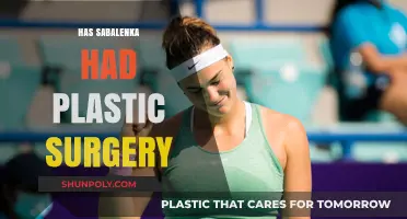 Has Aryna Sabalenka Undergone Plastic Surgery? Facts and Speculations