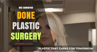 Samantha's Transformation: Plastic Surgery Rumors and the Truth Behind Them