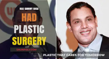 Sammy Sosa's Transformation: Uncovering the Truth About Plastic Surgery