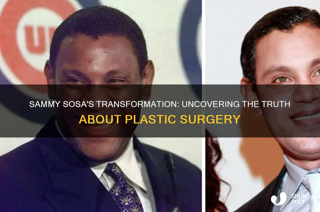 has sammy sosa had plastic surgery