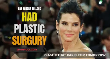 Sandra Bullock: Natural Beauty or Plastic Surgery?