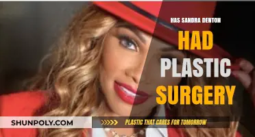 Sandra Denton's Transformation: Plastic Surgery Rumors Explored