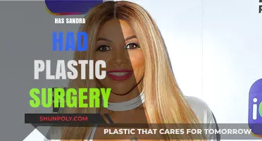 Sandra's Transformation: Unveiling the Truth About Plastic Surgery Rumors