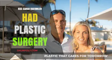 Sarah Baeumler's Transformation: Plastic Surgery Speculations and Facts Revealed