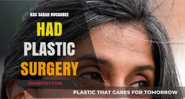 Sarah Huckabee Sanders' Transformation: Plastic Surgery Speculations Explored