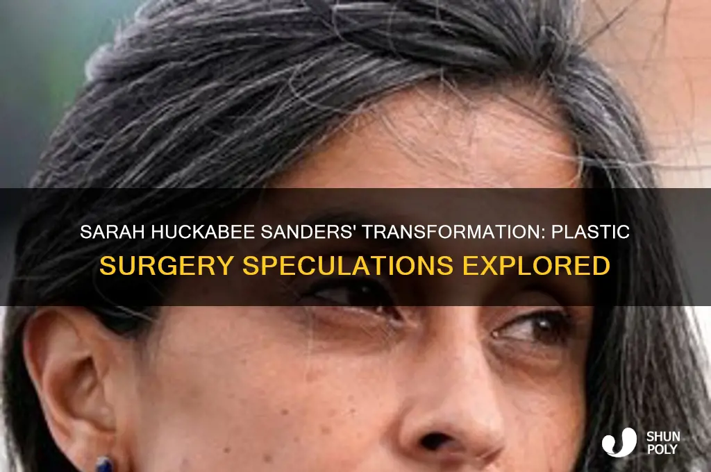 has sarah huckabee had plastic surgery