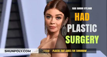 Sarah Hyland Plastic Surgery: Fact-Checking Her Transformation Rumors