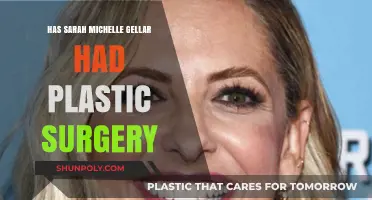 Sarah Michelle Gellar's Transformation: Plastic Surgery Rumors Explored