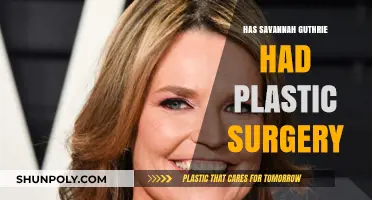 Savannah Guthrie's Transformation: Plastic Surgery Rumors Explored and Debunked