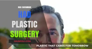 Savannah's Transformation: Plastic Surgery Rumors and the Truth Revealed