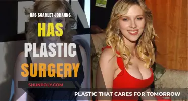 Scarlet Johansson Plastic Surgery: Fact-Checking the Rumors and Speculations